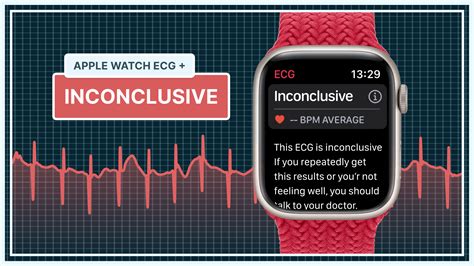 Unhealthy apple watch ecg results - The ECG app can record your heartbeat and rhythm using the electrical heart sensor on Apple Watch Series 4 or later and all models of Apple Watch Ultra* and then check the recording for atrial fibrillation (AFib), a form of irregular rhythm.. The ECG app records an electrocardiogram which represents the electrical pulses that make your …